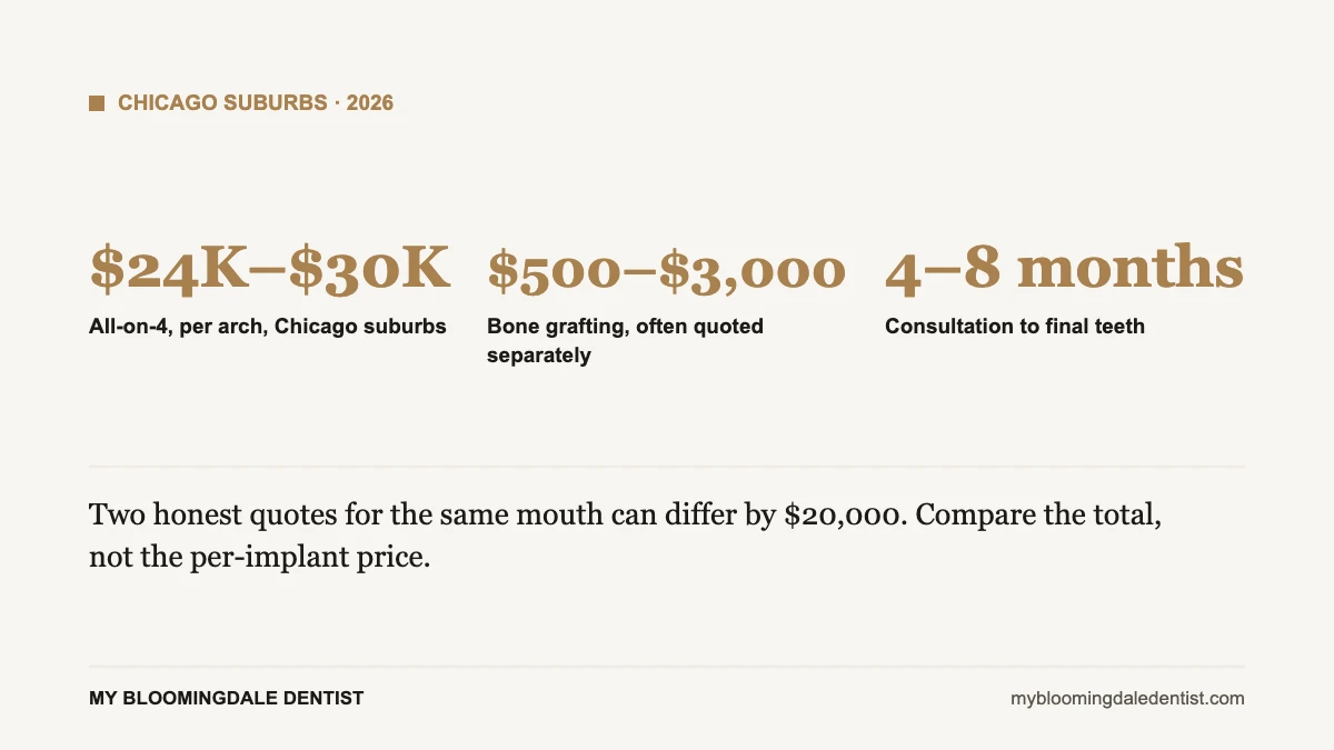 Chicago-area full arch implant price ranges and treatment timeline