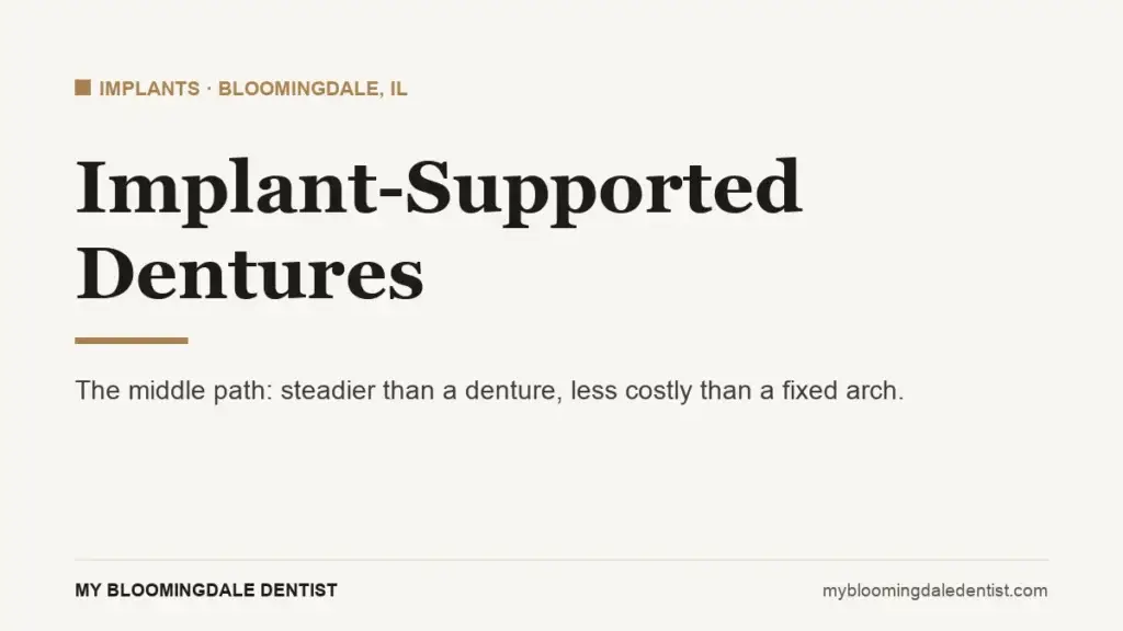 implant supported dentures: the middle path between dentures and fixed teeth