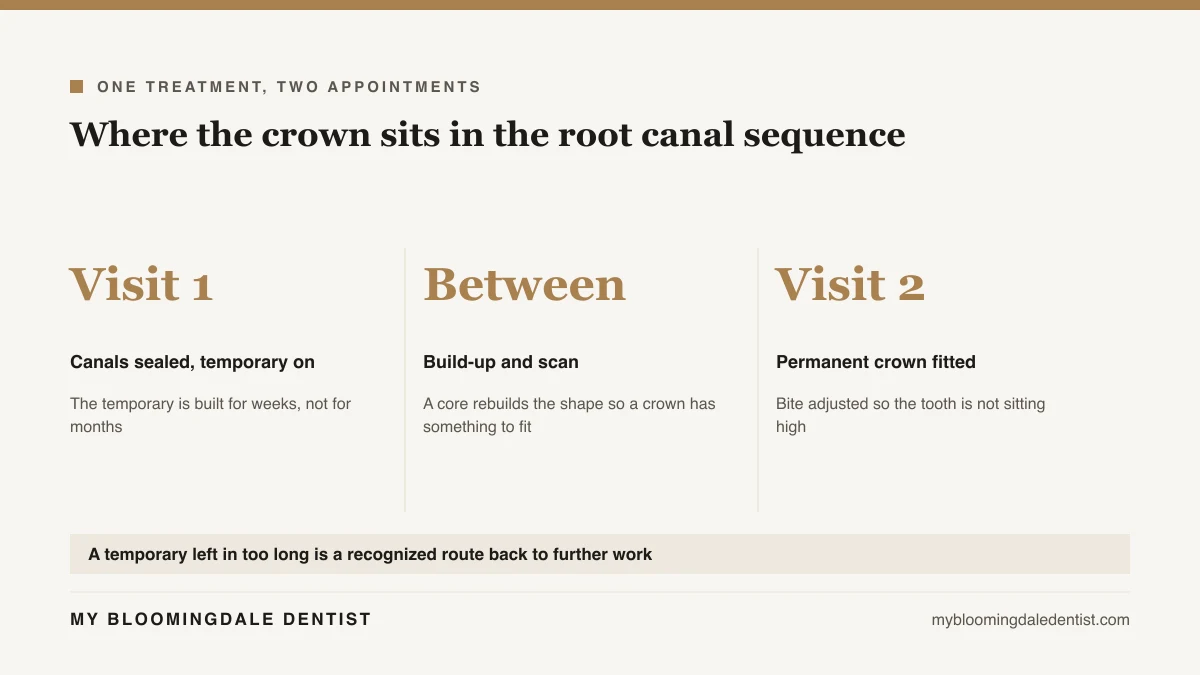 Diagram of the two-appointment sequence from root canal and temporary filling through to the permanent restoration