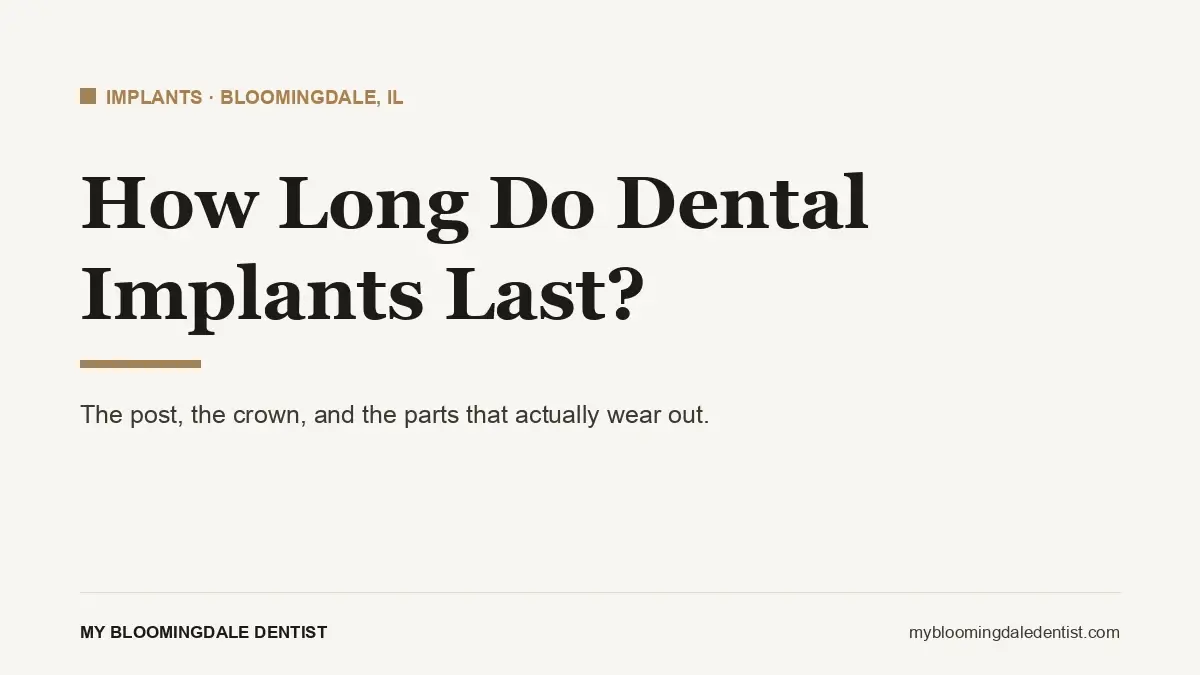 how long do dental implants last: the post, the crown and the parts that wear