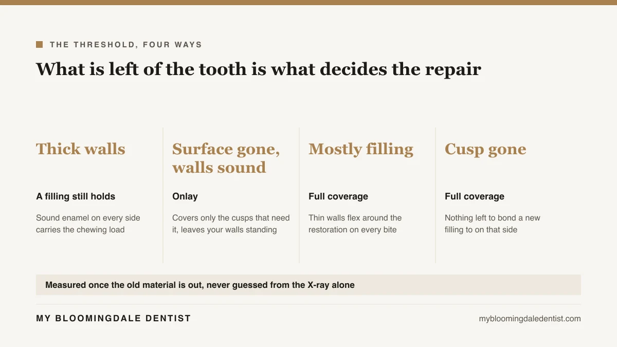 Diagram showing how much sound tooth wall is left in four restoration scenarios, including the onlay middle option, and which repair each one calls for