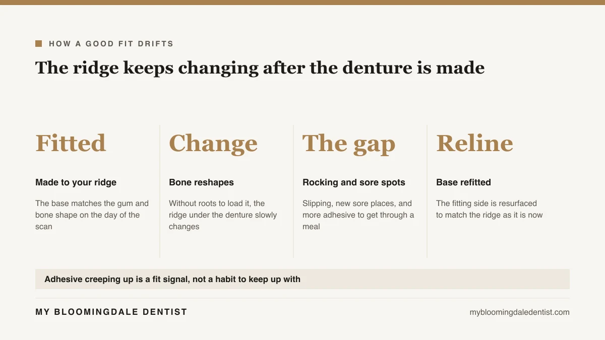 Four step diagram showing a denture fitted to the ridge, the ridge changing, the gap that opens, and a reline refitting the base