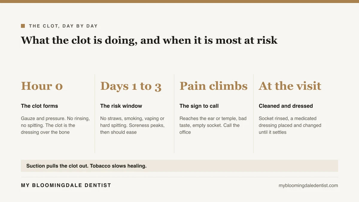 Four stage clot timeline after a tooth extraction, from the clot forming in the first hours through the risk window on days one to three, the climbing pain that signals dry socket, and the cleaning and dressing visit at the office